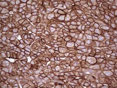 Immunohistochemistry: Galectin-9 Antibody (OTI1D12) - Azide and BSA Free [NBP2-71132]