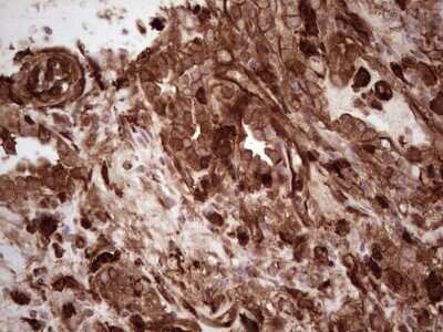 Immunohistochemistry: Galectin-9 Antibody (OTI1D12) - Azide and BSA Free [NBP2-71132]