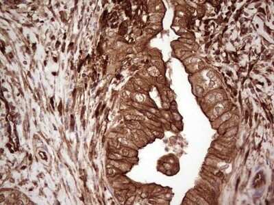 Immunohistochemistry: Galectin-9 Antibody (OTI1D12) - Azide and BSA Free [NBP2-71132]