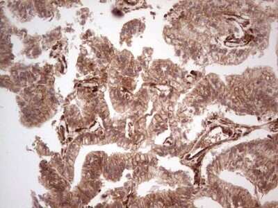 Immunohistochemistry: Galectin-9 Antibody (OTI1D12) - Azide and BSA Free [NBP2-71132]