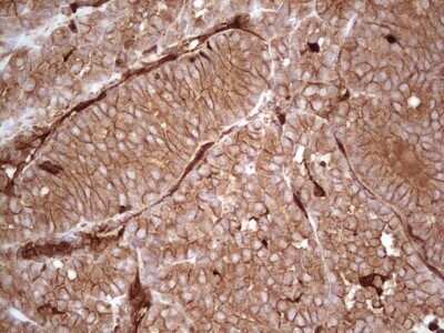 Immunohistochemistry: Galectin-9 Antibody (OTI1D12) - Azide and BSA Free [NBP2-71132]