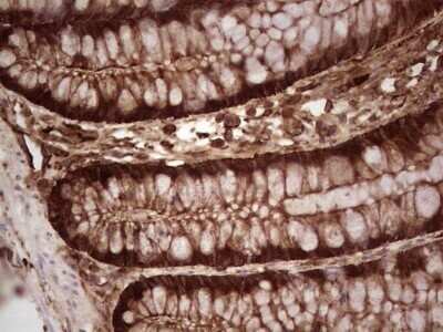 Immunohistochemistry: Galectin-9 Antibody (OTI1D12) - Azide and BSA Free [NBP2-71132]