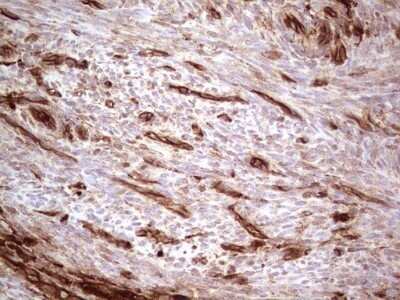 Immunohistochemistry: Galectin-9 Antibody (OTI1D12) - Azide and BSA Free [NBP2-71132]