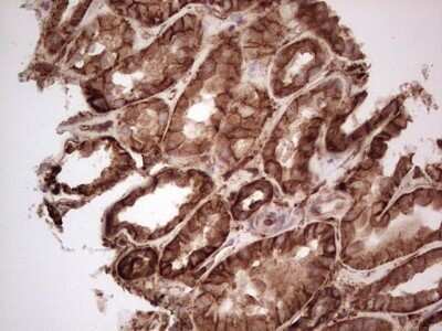 Immunohistochemistry: Galectin-9 Antibody (OTI1D12) - Azide and BSA Free [NBP2-71132]