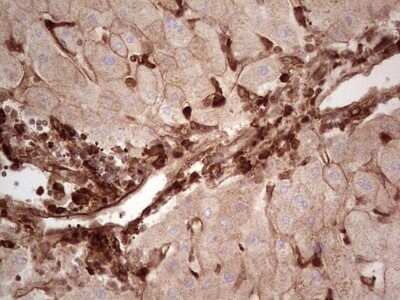 Immunohistochemistry: Galectin-9 Antibody (OTI1D12) - Azide and BSA Free [NBP2-71132]