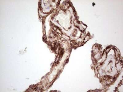 Immunohistochemistry: Galectin-9 Antibody (OTI1D12) - Azide and BSA Free [NBP2-71132]