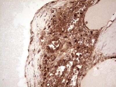 Immunohistochemistry: Galectin-9 Antibody (OTI1D12) - Azide and BSA Free [NBP2-71132]