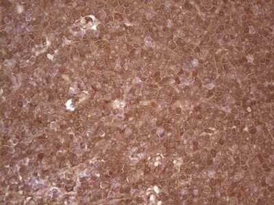 Immunohistochemistry: Galectin-9 Antibody (OTI1D12) - Azide and BSA Free [NBP2-71132]
