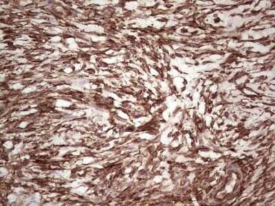 Immunohistochemistry: Galectin-9 Antibody (OTI1D12) - Azide and BSA Free [NBP2-71132]