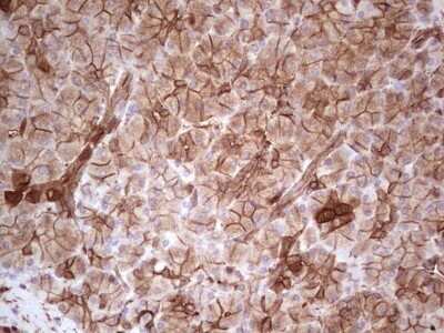 Immunohistochemistry: Galectin-9 Antibody (OTI1D12) - Azide and BSA Free [NBP2-71132]