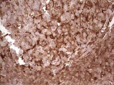 Immunohistochemistry: Galectin-9 Antibody (OTI1D12) - Azide and BSA Free [NBP2-71132]