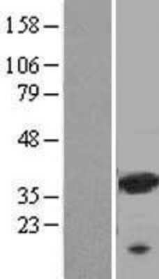 Western Blot: Galectin-9 Overexpression Lysate [NBL1-12505]