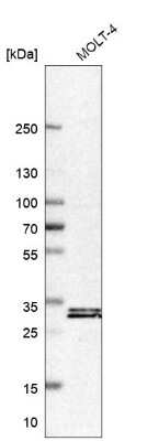 Western Blot: Galectin-9B Antibody [NBP2-33473]