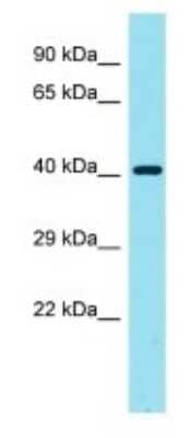 Western Blot: Galectin-9C Antibody [NBP3-09747]