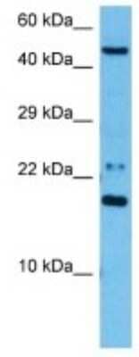 Western Blot: Galectin-related protein B Antibody [NBP3-10206]