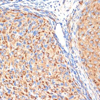Immunohistochemistry-Paraffin: Gamma Adaptin Antibody (4U2C8) [NBP3-15727]