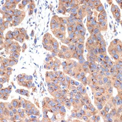 Immunohistochemistry-Paraffin: Gamma Adaptin Antibody (4U2C8) [NBP3-15727]