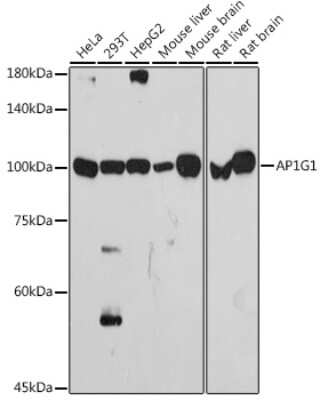 Western Blot: Gamma Adaptin Antibody (4U2C8) [NBP3-15727]