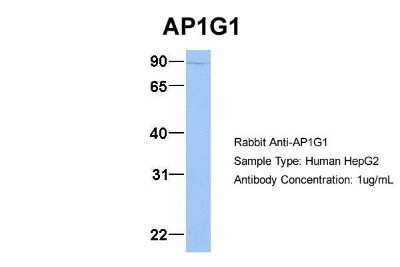 Western Blot: Gamma Adaptin Antibody [NBP1-57633]