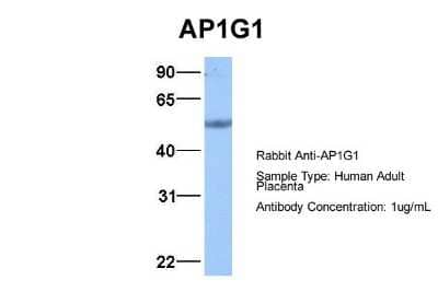 Western Blot: Gamma Adaptin Antibody [NBP1-57633]