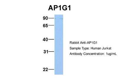Western Blot: Gamma Adaptin Antibody [NBP1-57633]