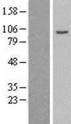 Western Blot: Gamma Adaptin Overexpression Lysate [NBL1-07575]