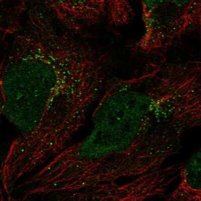 Immunocytochemistry/ Immunofluorescence: Gamma-Glutamyltransferase 7 Antibody [NBP2-55289]