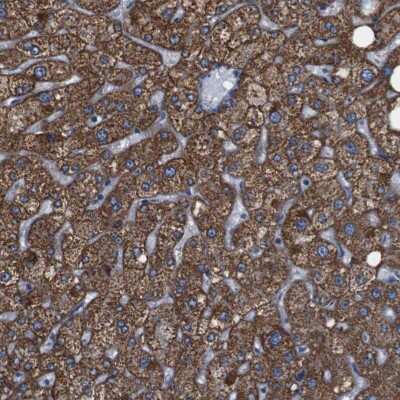 Immunohistochemistry-Paraffin: Gamma-Glutamyltransferase 7 Antibody [NBP1-84319]
