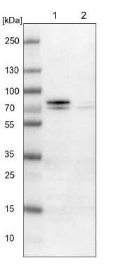 Western Blot: Gamma-Glutamyltransferase 7 Antibody [NBP1-84319]