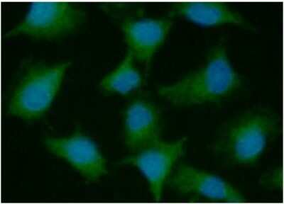 Immunocytochemistry/ Immunofluorescence: Gankyrin Antibody (1F4) - BSA Free [NBP2-59400]