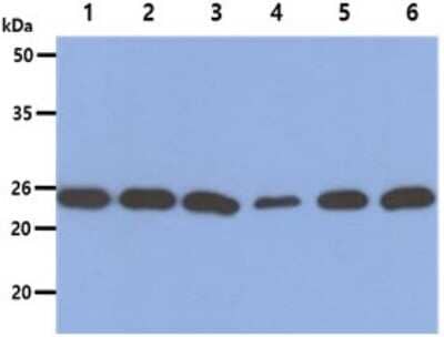 Western Blot: Gankyrin Antibody (1F4)BSA Free [NBP2-59400]