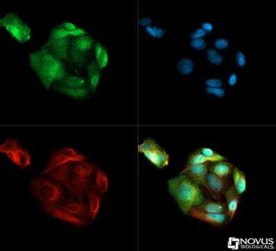 Immunocytochemistry/ Immunofluorescence: Gankyrin Antibody [NB100-1834]