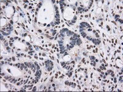 Immunohistochemistry: Gankyrin Antibody (OTI3F6) - Azide and BSA Free [NBP2-71267]