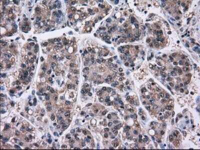 Immunohistochemistry: Gankyrin Antibody (OTI3F6) - Azide and BSA Free [NBP2-71267]