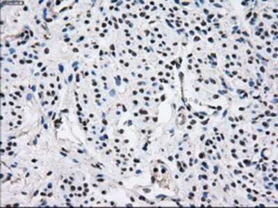 Immunohistochemistry: Gankyrin Antibody (OTI3F6) - Azide and BSA Free [NBP2-71267]