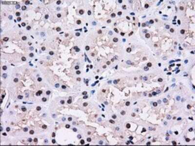 Immunohistochemistry: Gankyrin Antibody (OTI3F6) - Azide and BSA Free [NBP2-71267]