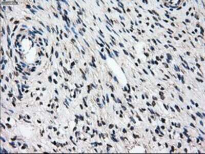 Immunohistochemistry: Gankyrin Antibody (OTI3F6) - Azide and BSA Free [NBP2-71267]