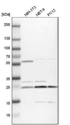 Western Blot: Gankyrin Antibody [NBP1-82443]