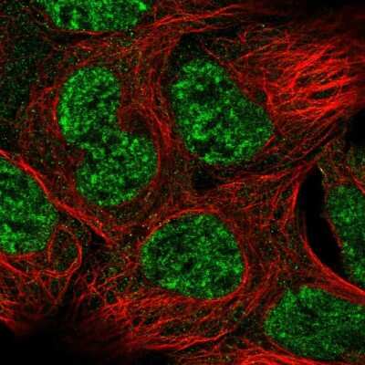 Immunocytochemistry/ Immunofluorescence: Gas1 Antibody [NBP2-55014]