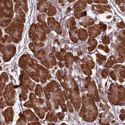 Immunohistochemistry: Gas1 Antibody [NBP2-49497]