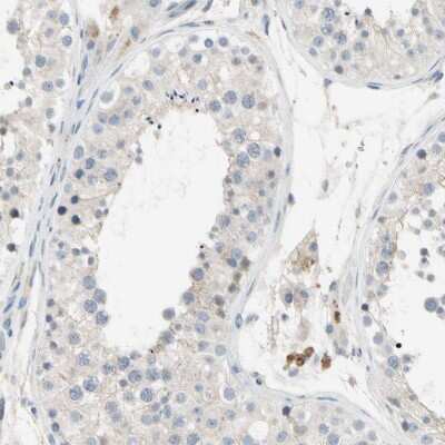 Immunohistochemistry-Paraffin: Gas6 Antibody [NBP1-90059]