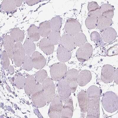 Immunohistochemistry-Paraffin: Gasdermin-A Antibody [NBP2-48564]
