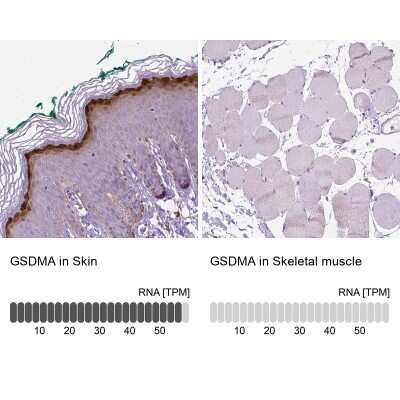 Immunohistochemistry-Paraffin: Gasdermin-A Antibody [NBP2-48564]