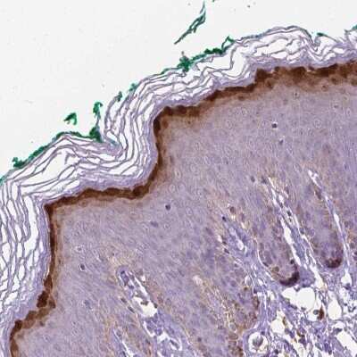 Immunohistochemistry-Paraffin: Gasdermin-A Antibody [NBP2-48564]