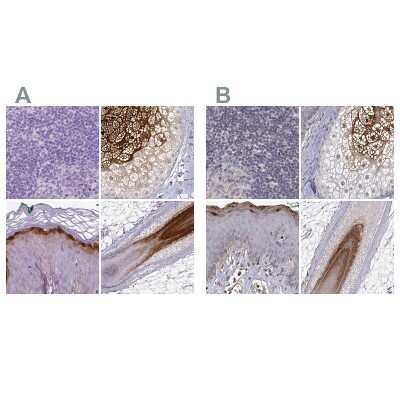Immunohistochemistry-Paraffin: Gasdermin-A Antibody [NBP2-48564]