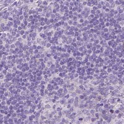 Immunohistochemistry-Paraffin: Gasdermin-A Antibody [NBP2-48564]