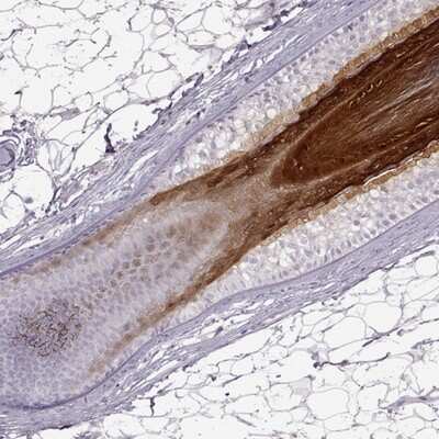 Immunohistochemistry-Paraffin: Gasdermin-A Antibody [NBP2-48564]