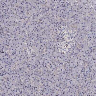 Immunohistochemistry-Paraffin: Gasdermin-A Antibody [NBP2-49426]