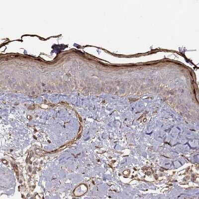 Immunohistochemistry-Paraffin: Gasdermin-A Antibody [NBP2-49426]