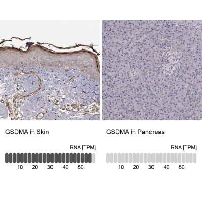 Immunohistochemistry-Paraffin: Gasdermin-A Antibody [NBP2-49426]